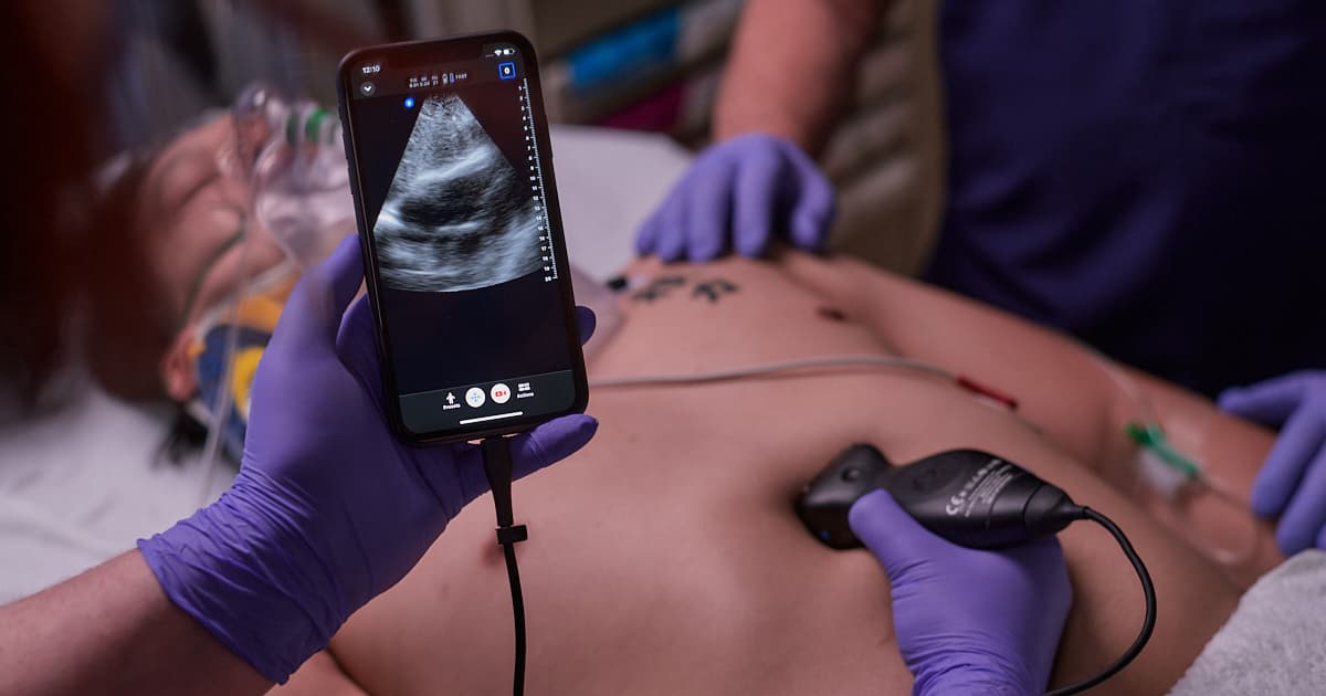 Image of EMS Ultrasound